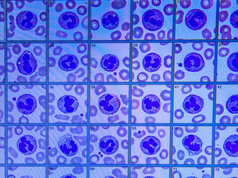 Digital image of whole blood slides used to identify and count red cells, white cells and platelets